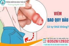 10 Cách chữa viêm bao quy đầu tại nhà ở nam giới