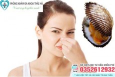 10 Cách trị vùng kín có mùi hôi và ngứa tại nhà
