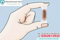 Vùng kín ra dịch màu nâu đen không mùi có sao không?