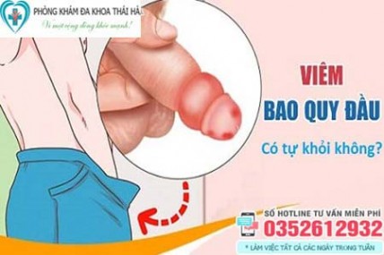 10 Cách chữa viêm bao quy đầu tại nhà ở nam giới