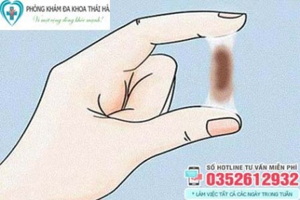 Vùng kín ra dịch màu nâu đen không mùi có sao không?