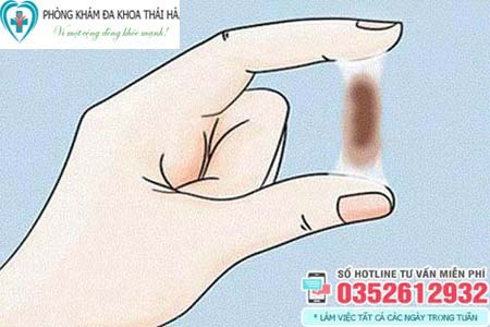 Vùng kín ra dịch màu nâu đen không mùi có sao không?
